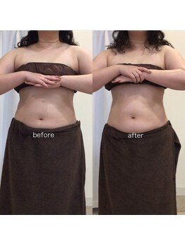 ジョワイユ(Joyeux)/腸の位置でお腹は変わる