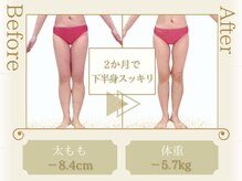 ピュアエステブリアント 銀座店/お客様の結果［銀座/痩身］