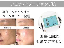 ルーミー(LUME.)の雰囲気(【シミケアし放題】細かいシミにもアプローチ)