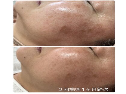 エビアス(Ebias)の写真