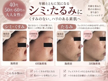 ラ コリーヌ(La Colline)の写真