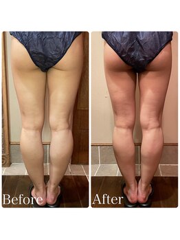 ビューティースタイリング 自由が丘店(beauty styling)/【ボディ】太ももに隙間を♪