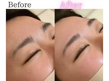 イーサム(e-sam)/美眉WAX脱毛