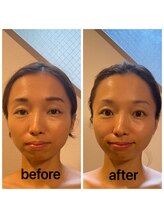 ディグニータココ 自由が丘(DIGNITA coco)/☆before after☆