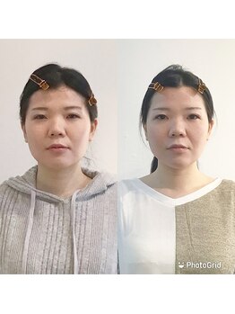 シンメトリー 麻布十番/Before/After