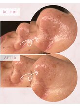 プレジール(Plaisir)/サーマトリックス★