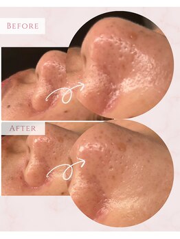 プレジール(Plaisir)/サーマトリックス★