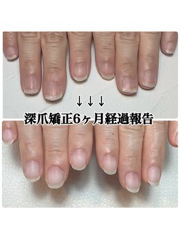 スマイルニコ(smile nico)/平爪が縦長爪に！