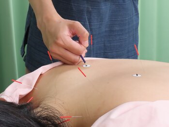 ナディ鍼灸治療院/鍼灸トータルケア
