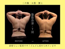 ブルースター 上小田井店(Blue Star)/全身８カップ×７回