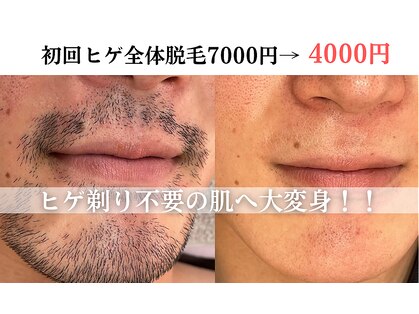 レオ(LEO)の写真
