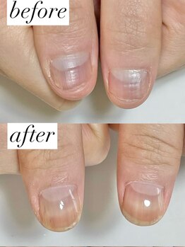 ニコワイズネイル(Nico Y's Nail)/【自爪育成コース】