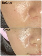 アスピリア(aspirer a')/お手軽フェイシャル◎