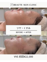 ボーテスキンクリニック/VVS【TROIAREUKE】