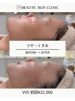 ボーテスキンクリニック/VVS【TROIAREUKE】