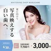 ホワイトニングショップ 香川丸亀店