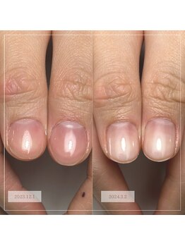 ノウェム(Novem)/