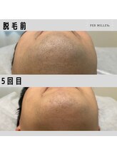 パーミル 楠葉店(per mille‰)/Before/After