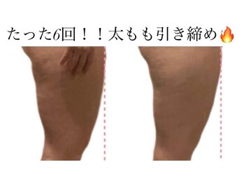 痩身革命 大宮店/ダイエットリンパマッサージ