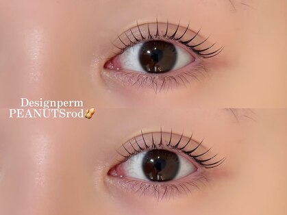ヴィジョン(vision)の写真