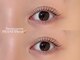 ヴィジョン(vision)の写真