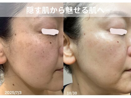 カンパニュラ(campanula)の写真