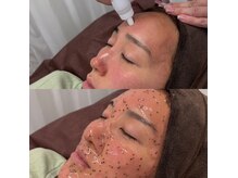 マカナ(makana)の雰囲気（ハイドラスプラッシュ導入♪毛穴撲滅作成！今だけクーポン配信♪）