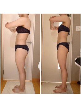 パルティール 恵比寿店(partir)/太もも、前張り改善で脚長効果！