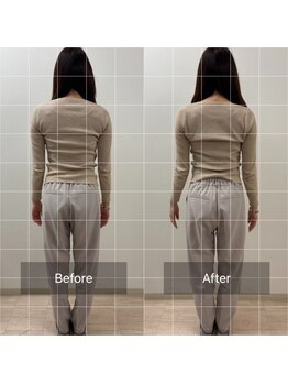 トニック バイ まつもと整骨院鍼灸院(Tonic)/★Before After★豊中/腰痛