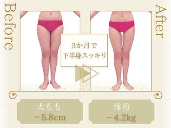 ピュアエステブリアント 銀座店/お客様の結果［銀座/痩身］