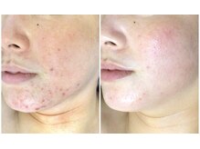 クレビア(CREBIA)/