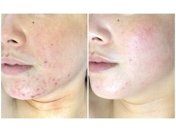 クレビア(CREBIA)/