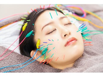 ヴィーライン 上大岡(VeLine)の写真/眼精疲労と頭痛の改善をサポート!鍼で頭のコリをリセットして軽やかなお顔へ◎