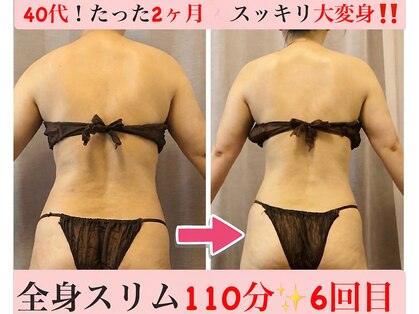 マール(Mar)の写真