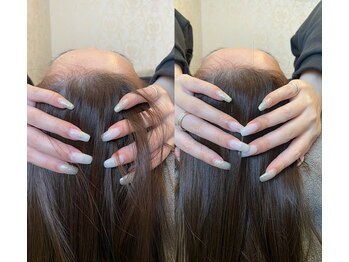 シンデレラ/プレミアム小顔矯正