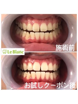 ルブラン 奈良店(Le Blanc)/最初は半信半疑でも。。。