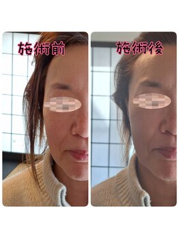 縁 エン/ヘッドマッサージ☆