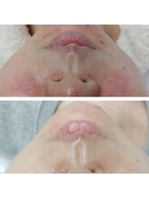 ココスタイルビューティー(COCOSTYLE beauty)/ララピール