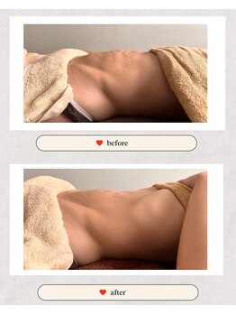 ウェルビー(Well & Be.)/【Hot腸もみ】