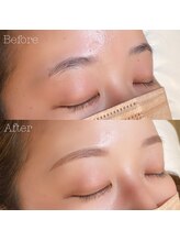 ベルム 横浜店(BELME)/横浜 まつぱ　間引き 眉毛