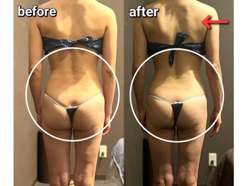 ピーチベル 美濃加茂店(PeachBell)/全身デトックス