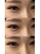 ビューティマーケット アングゥ(BEAUTY MARKET ungu)/パッチリ