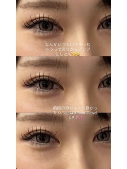 ビューティマーケット アングゥ(BEAUTY MARKET ungu)/パッチリ