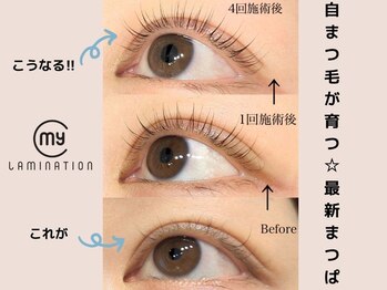 マイロ(Myro)/最新技術マイラミネーション