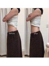 ジョワイユ(Joyeux)/腸の位置でお腹は変わる