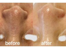 ナチュラ ソース(NatureSouce)