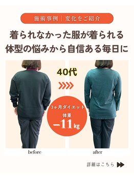 みやざと整体院/ダイエット実績（痩身・整体）