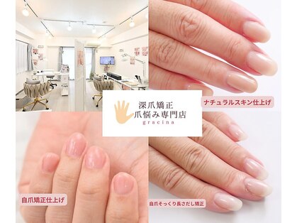 深爪矯正 爪悩み専門店 グラシナ 西宮北口店【4/3 NEW OPEN（予定）】の写真