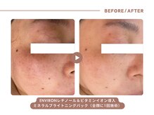 イエス マイサロン(yes My Salon)/ENVIRONトリートメント症例