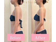 ヴェルセーヌ(VelleSaine)/ブライダル痩身/肩甲骨/デコルテ